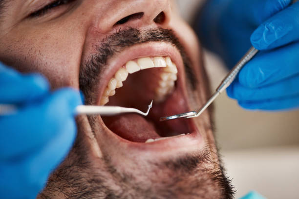 Best Emergency Treatment for Oral Infections in Flowery Branch, GA