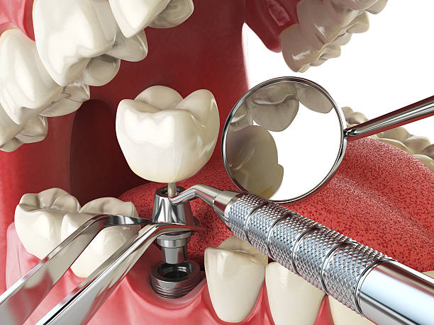 Best Emergency Denture Repair in Flowery Branch, GA